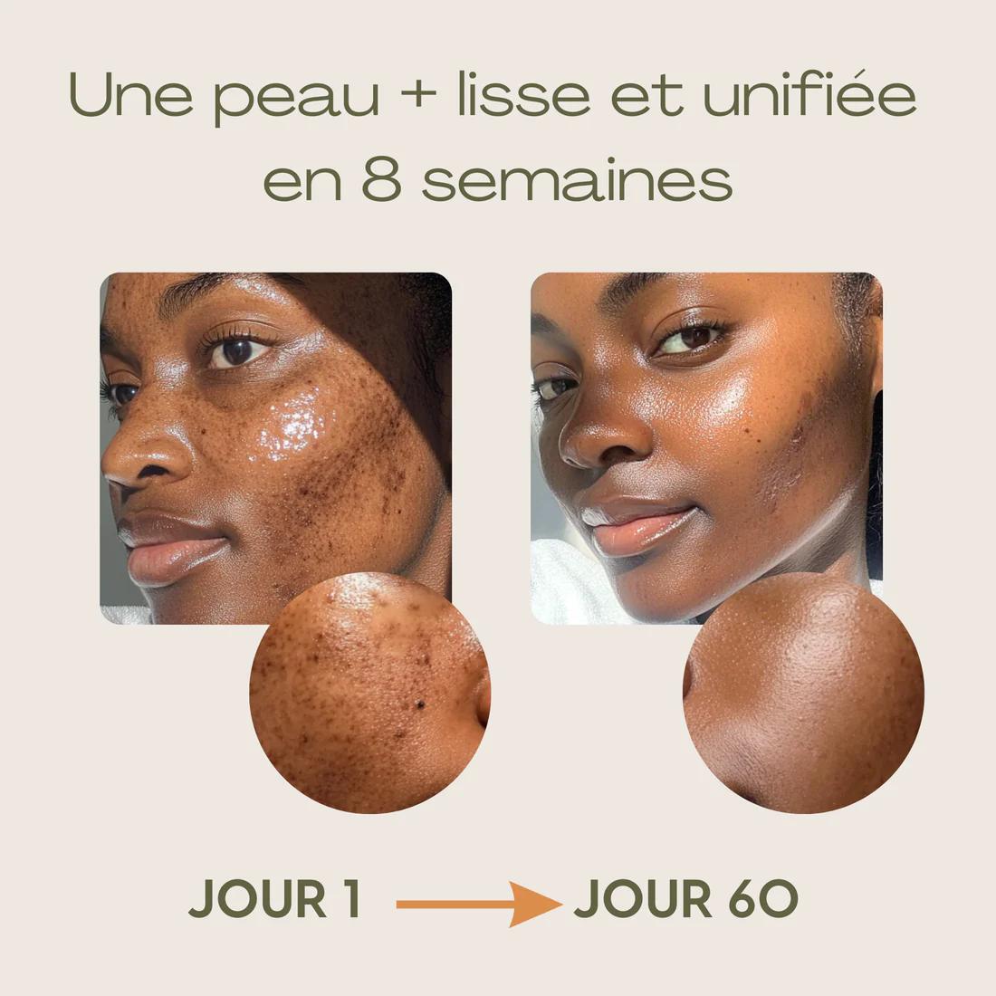 GlowCurcuma : zéro bouton, zéro tache en 30 jours