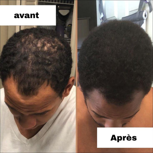 Romarin vitalité croissance naturelle