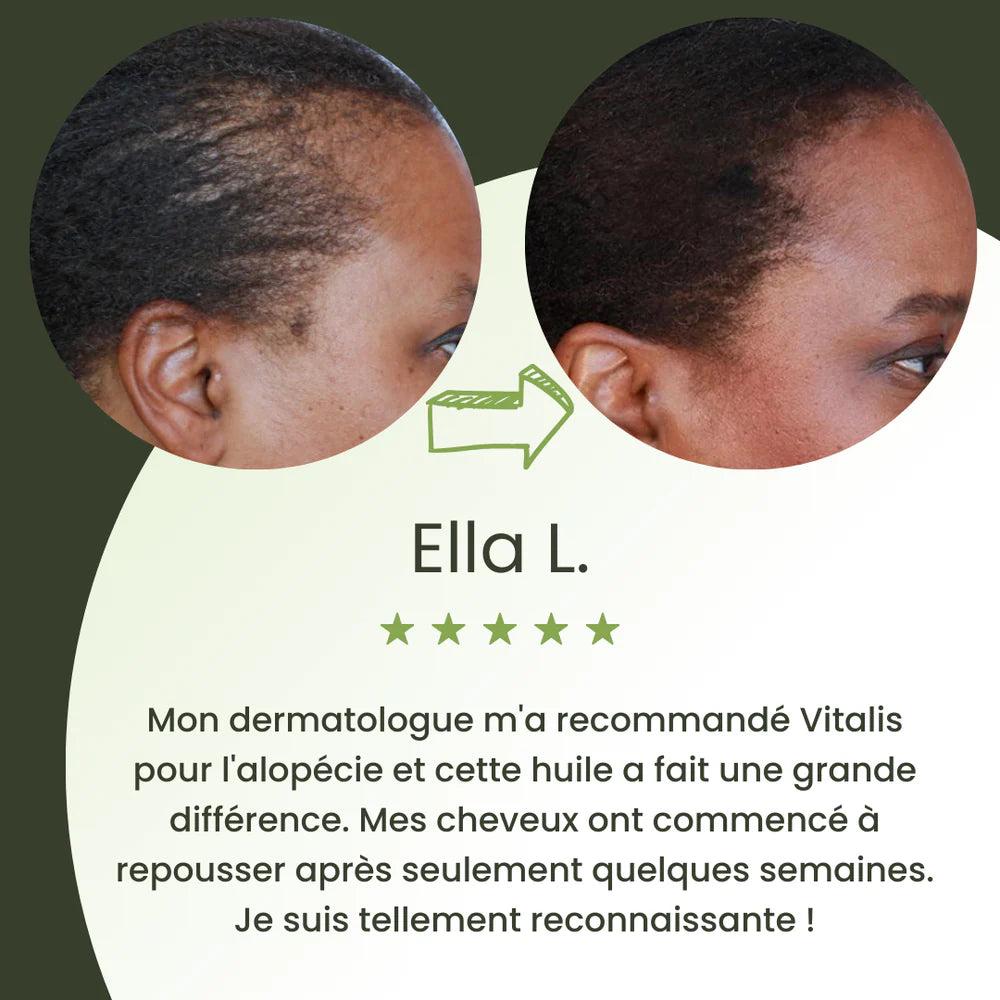 Romarin Boost™ – Croissance Capillaire Rapide & 100% Naturelle, Des cheveux plus forts et plus denses dans une semaine