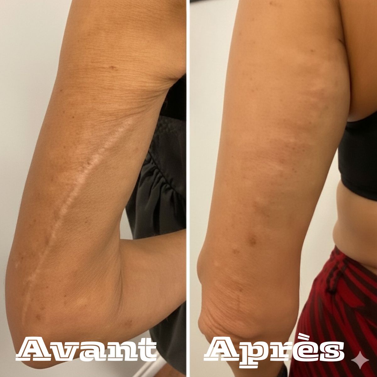 Restore Cream-La crème qui remplace toute votre routine