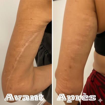 Restore Cream-La crème qui remplace toute votre routine