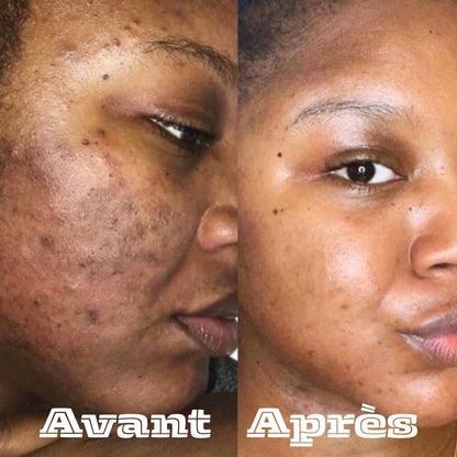 Restore Cream-La crème qui remplace toute votre routine