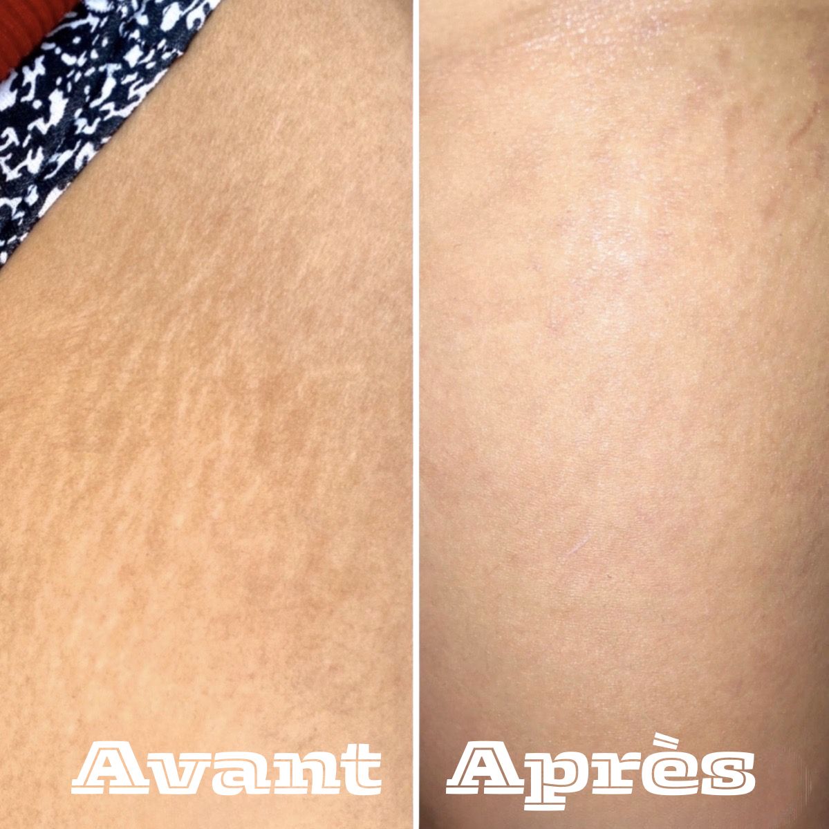 Restore Cream-La crème qui remplace toute votre routine