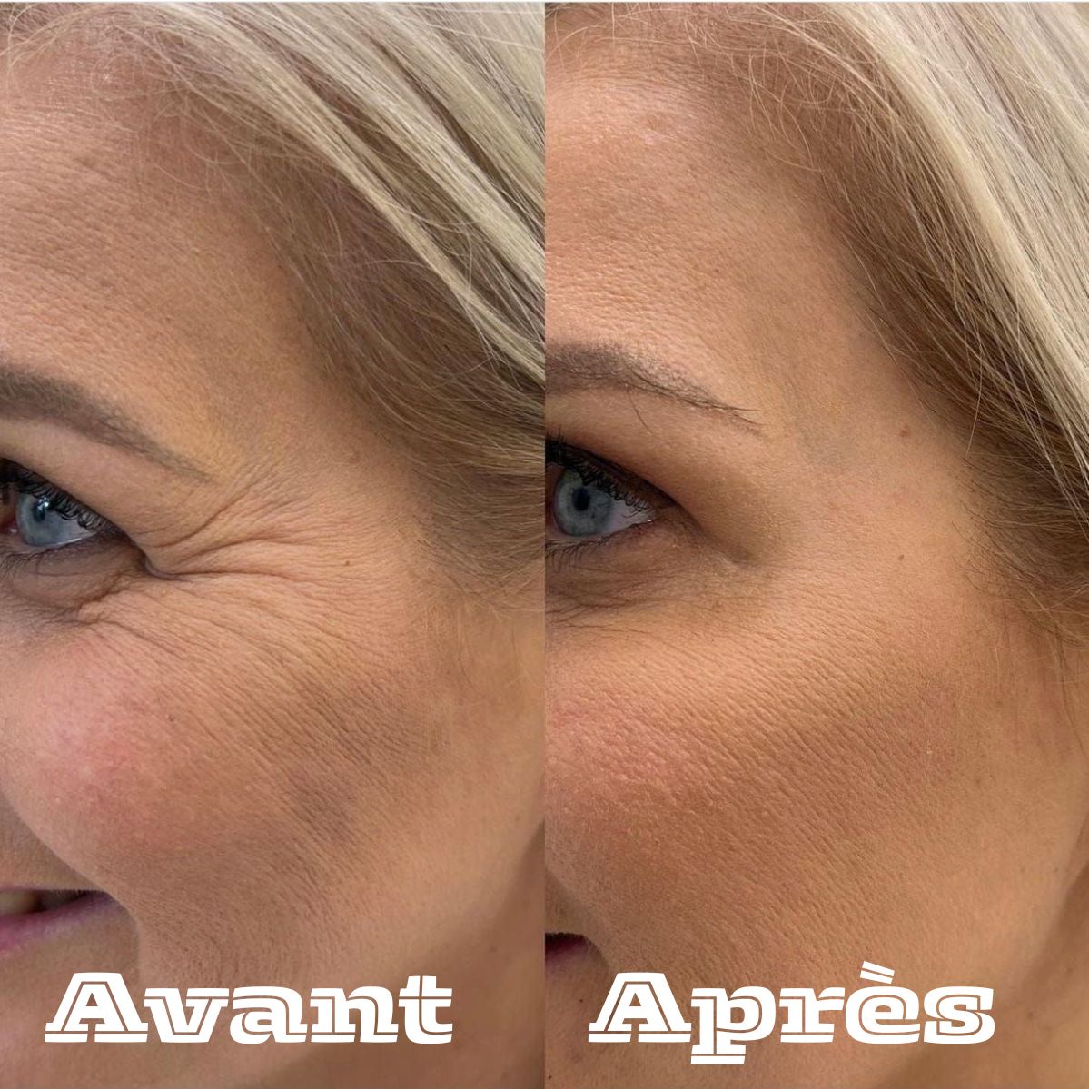 Restore Cream-La crème qui remplace toute votre routine