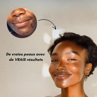 GlowCurcuma : zéro bouton, zéro tache en 30 jours