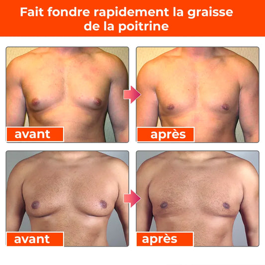 Torse ferme, au Venin d’Abeille